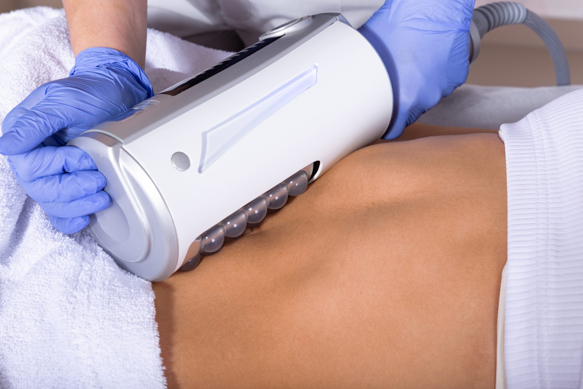 Procedure image